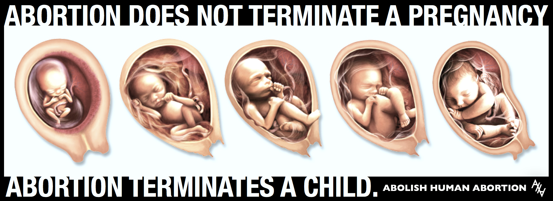 ABORTION TERMINATES
